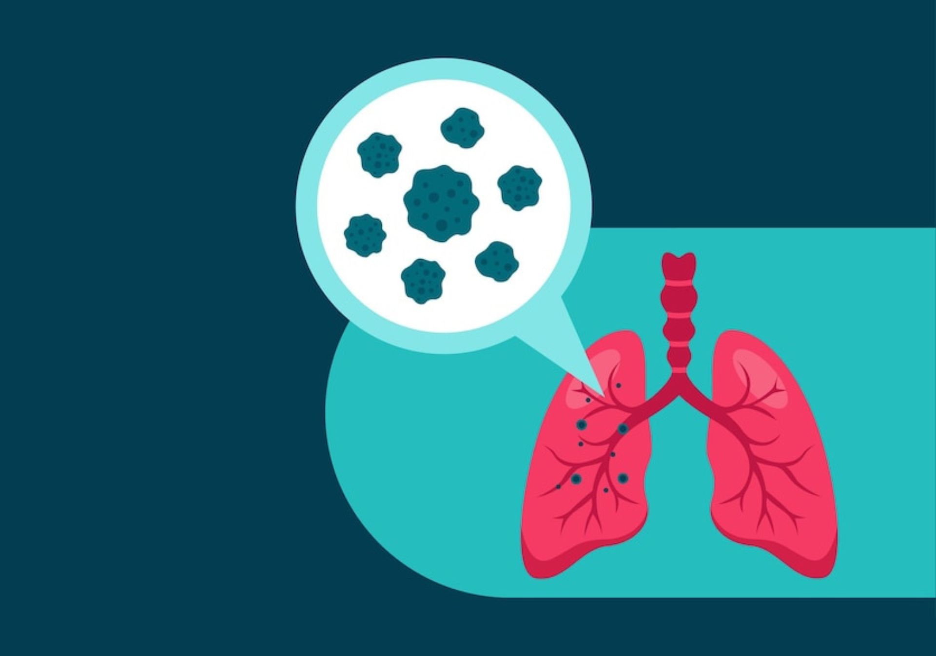 Día Mundial de la Tuberculosis: datos clave sobre una enfermedad prevenible y tratable